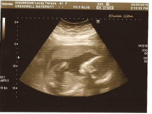 Teresalsfinalscan Pics.jpg