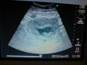 Teresals2ndscan Pics 001.jpg